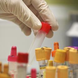 A hand with a medical glove picking up a test tube